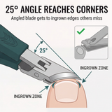 TrimEase - Angled Toenail Clippers for Thick Nails